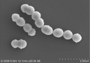 group a streptococcus typically causes swelling and sore throat in children but some types of the bacteria can lead to symptoms developing rapidly national institute of infectious diseases via jiji